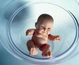 体外受精 IVF-ET